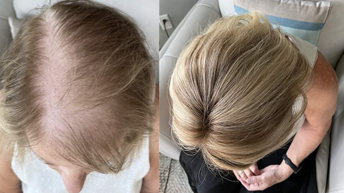 Robyn Sullivan of the new Sullivan Hairwear is open about sharing her experience with hair loss and even takes off the toppers she sells to show people the before and after of what her hair looks like. “I’m like a party trick at this point.”