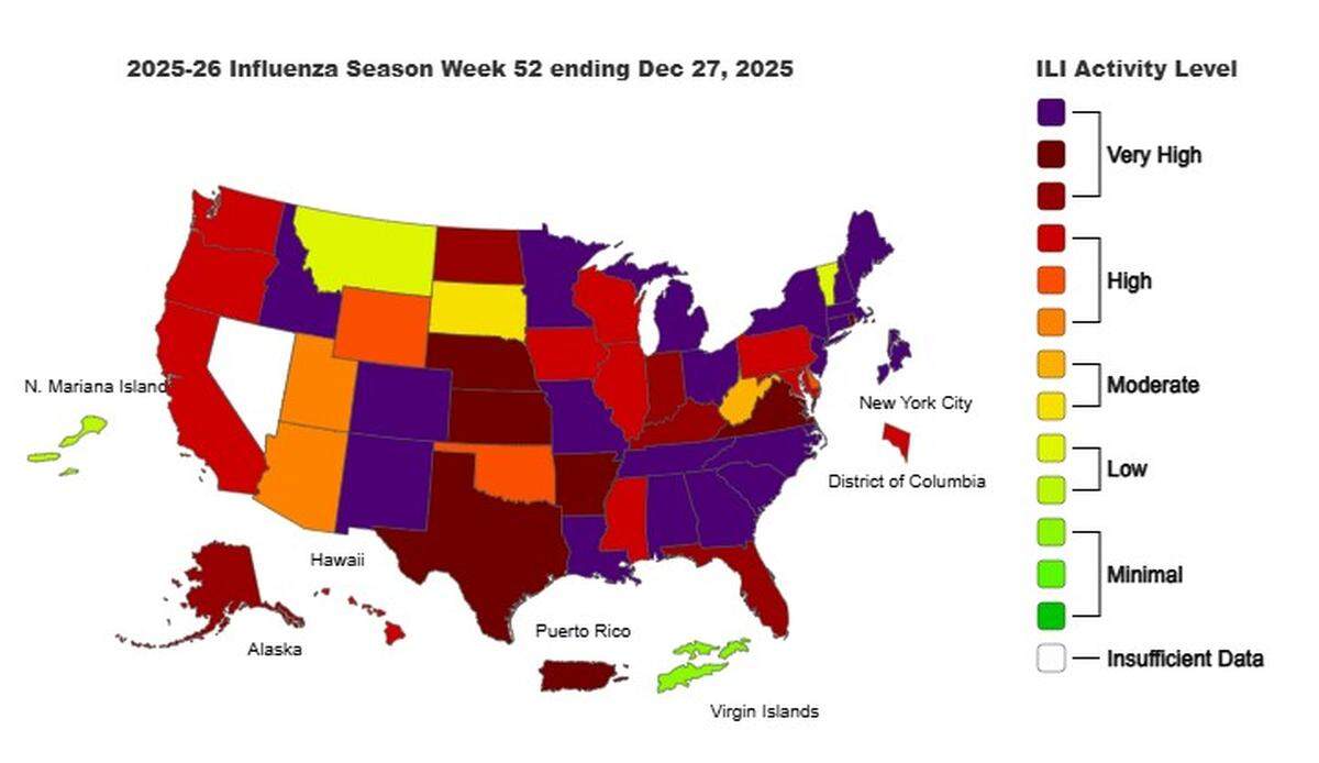 See CDC’s influenza activity map for the week ending Dec. 27, 2025.