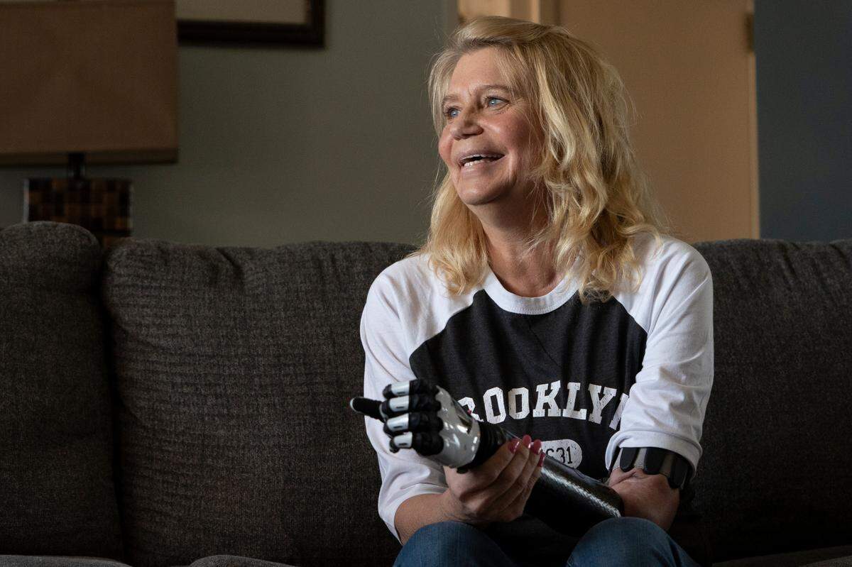 With the help of Ascension Via Christi and New York’s Hospital for Special Surgery Limb Salvage and Amputation Reconstruction Center, Wichita amputee Sondra Stieber has gone from what she calls a barbaric hook for an arm to a bionic one that she said can changes the lives of other amputees.