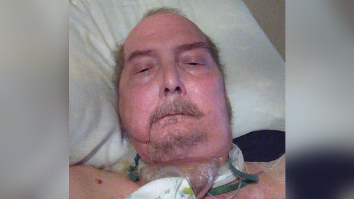 David Auble is a lifelong Republican who supported Donald Trump. He wants members of the Kansas Senate to see how they could help cancer patients like him.