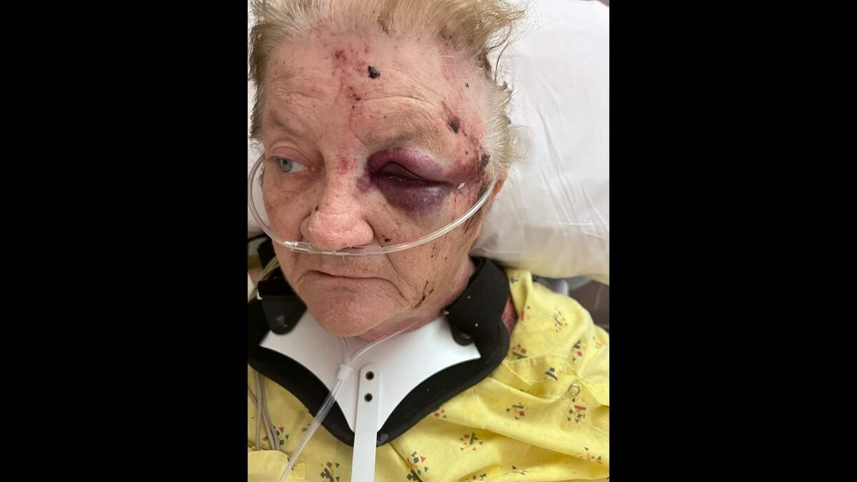 Kathy Moore was hospitalized after a tornado crushed her and her husband under their home in rural Sedgwick County on Friday. Moore’s daughter, Jamie Seipel, took this photo of her mother at the hospital on Saturday.
