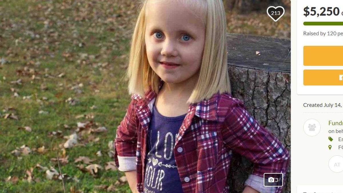 In a “freak accident,” Paizlee Crumby was hit in the back of her head by a softball in July. The “little fighter” is back home after several surgeries.