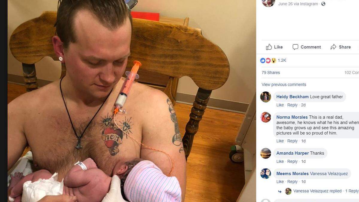 Maxamillian Neubauer used a "fake nipple" — a nipple shield with a baby formula syringe —to breastfeed his newborn baby while his wife was unconscious. He's calling it the "moob" — for man and boob.