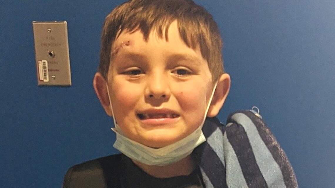 Kansas boy, shot by trespasser while hunting, recovering from head injury