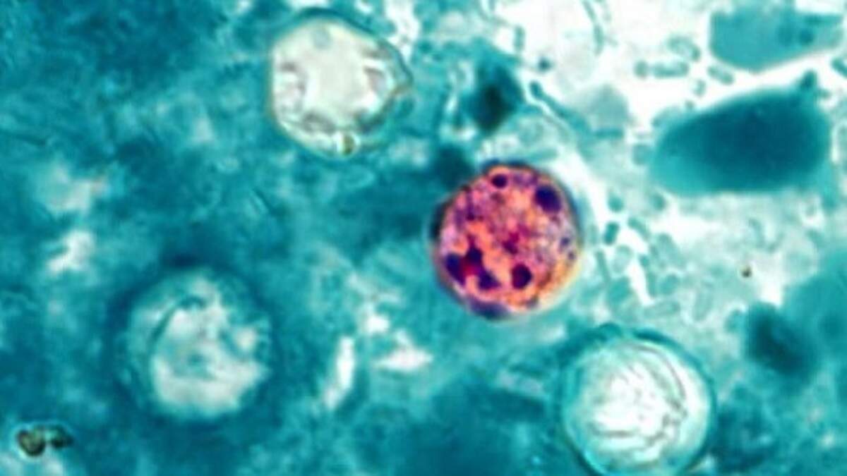 The Centers for Disease Control and Prevention has received report of over 800 cases of cyclosporiasis acquired within the U.S. between May 1 and July 9.