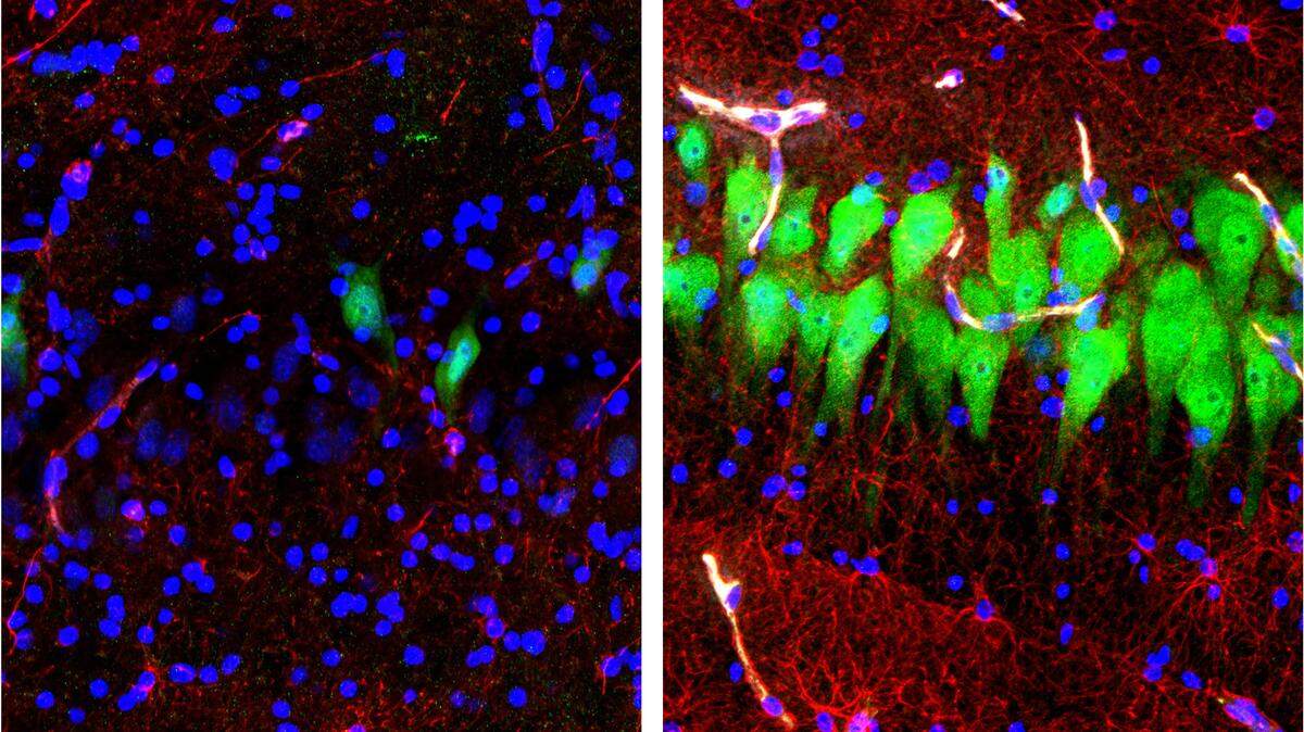 “This combination of images provided by the Yale School of Medicine in April 2019 shows stained microscope photos of neurons, green; astrocytes, red, and cell nuclei, blue, from a pig brain left untreated for 10 hours after death, left, and another with a specially designed blood substitute pumped through it,” the AP reported.