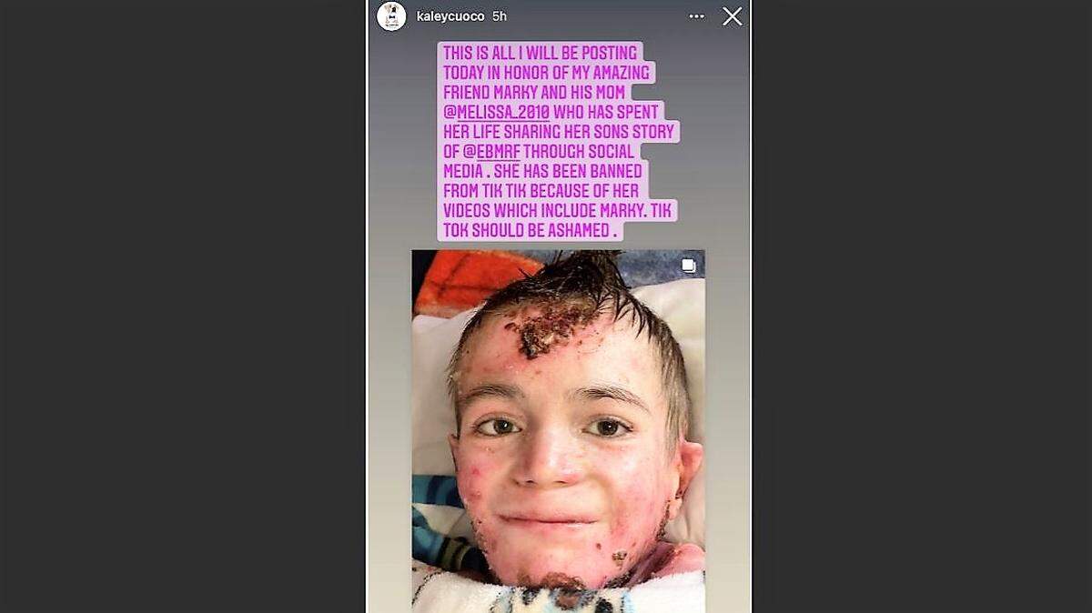This screenshot of a story post by Big Bang Theory star Kelly Cuoco was one of several put on social media Friday by celebrities defending Marky Burrola-Jaquez, after his and his mom’s TikTok site was shut down. The initial reason TikTok gave for closing the account was that his picture was “excessively gruesome,” but the company later restored the account and said it was a mistake over his age.