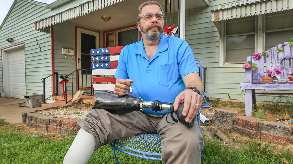 Monty Rush sits in front of his south Wichita home Thursday. He lost his leg to a flesh-eating bacteria after stepping on a nail five years ago. He and his wife are starting a support group for other amputees and are holding an amputee cook-out this month.