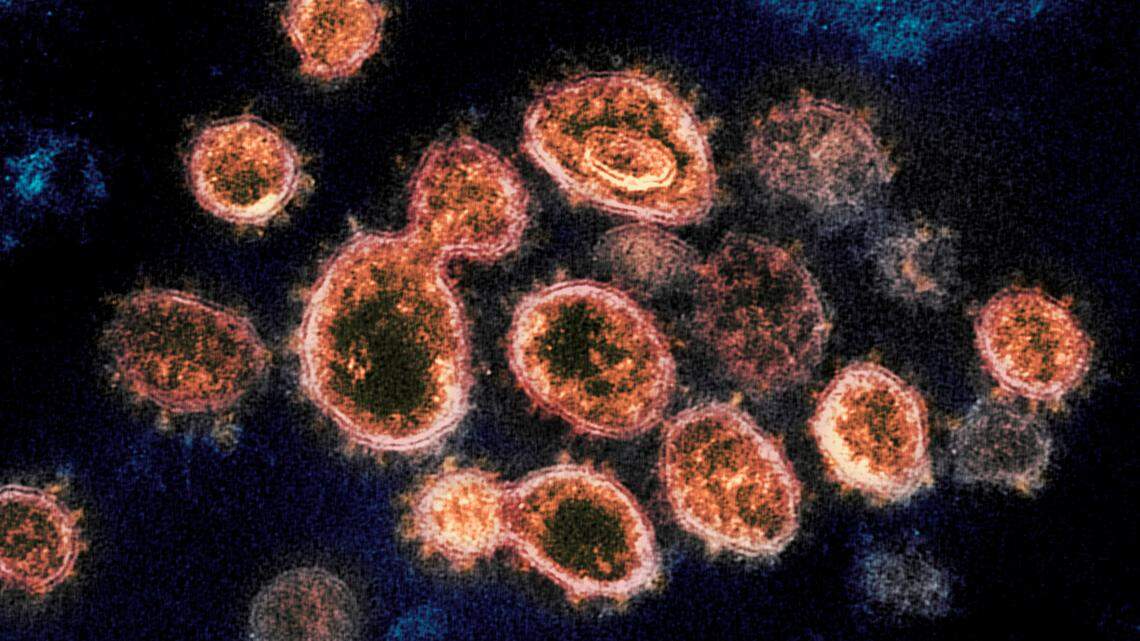 This 2020 electron microscope image provided by the National Institute of Allergy and Infectious Diseases - Rocky Mountain Laboratories shows SARS-CoV-2 virus particles which cause COVID-19, isolated from a patient in the U.S., emerging from the surface of cells cultured in a lab.