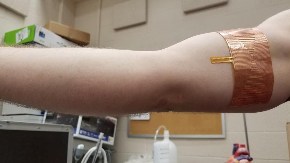 The skin patch sensor can test for things like blood gas levels and muscle degeneration.