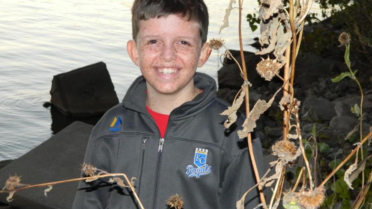 Peyton Madden, 11, of El Dorado has a disease so rare only 250 people in the U.S. have been diagnosed with it. His body can’t process sunlight. A special event is planned Friday night so he can play with his friends without being sickened by the sun.