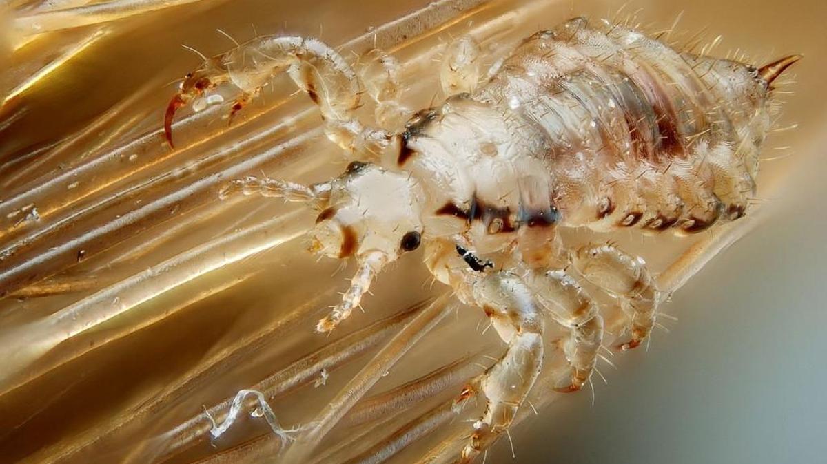 This microscopic view shows a male human head louse, Pediculus humanus capitis.