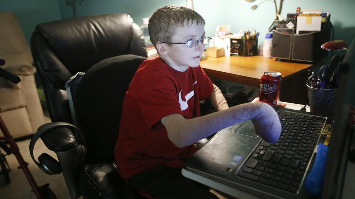 
Kyle Hicks types on his home computer. The 24-year-old was born with a rare skin disease that makes his skin very fragile. He received a bone marrow transplant in Minneapolis in 2011 and since then has been working online from home towards a degree from Butler Community College. He just received the degree and plans to take online classes from Kansas State. (May 12, 2015)
