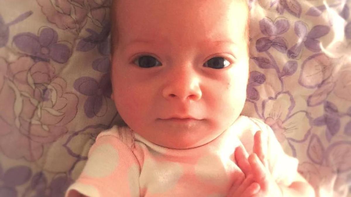 Five-month-old Molly had a hair wrapped around her toe that caused it to swell and bleed. The condition is called hair tourniquet. Her story went viral online when her father, Scott Walker of Wichita, posted about it on Facebook. (Feb. 4, 2016)