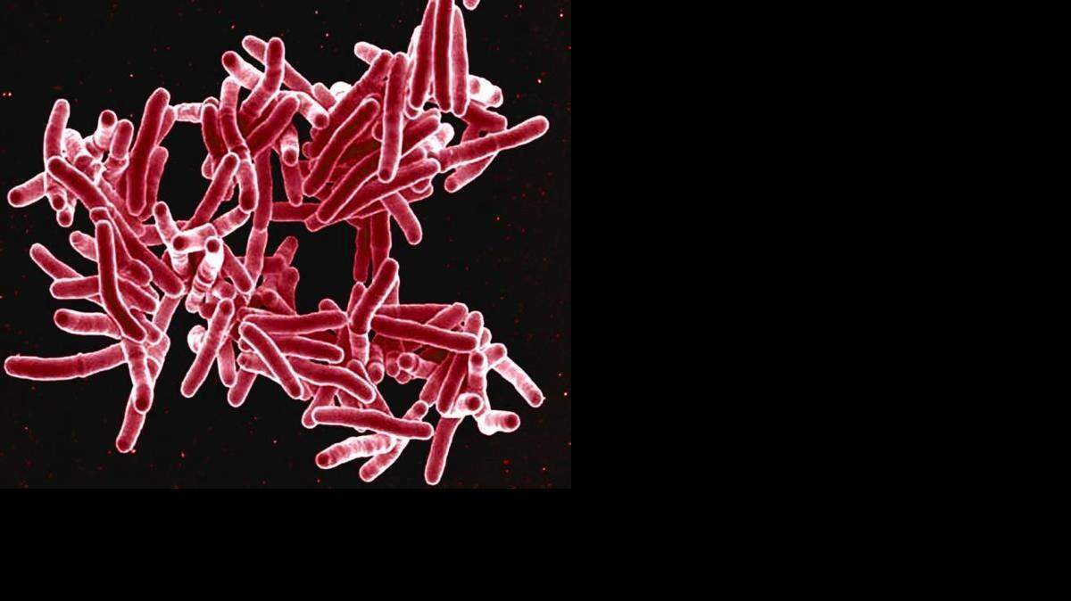 
Produced by the National Institute of Allergy and Infectious Diseases, this digitally-colorized scanning electron micrograph depicts a grouping of red-colored, rod-shaped Mycobacterium tuberculosis bacteria, which cause tuberculosis (TB) in human beings.
