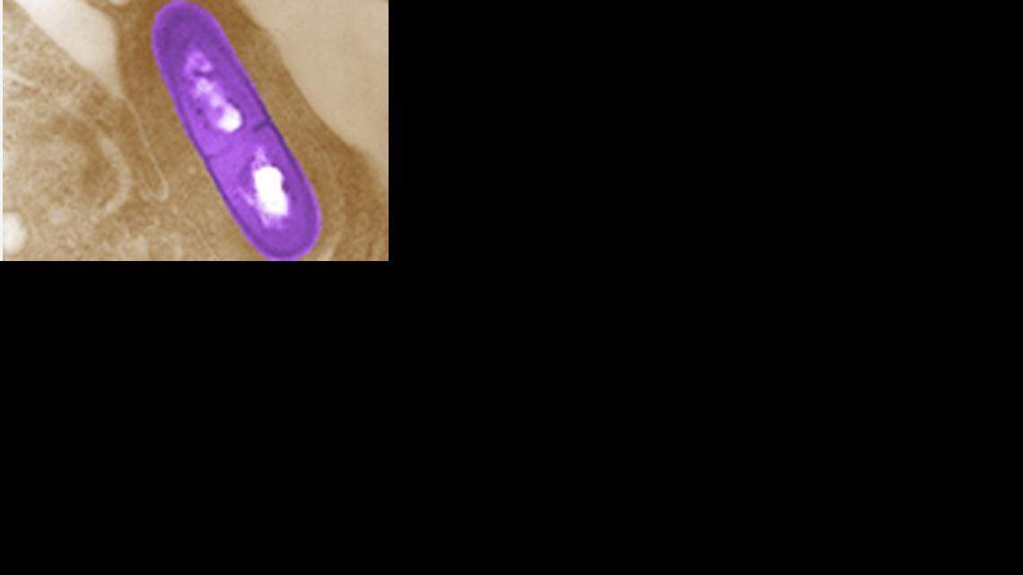 
Listeria monocytogenes
