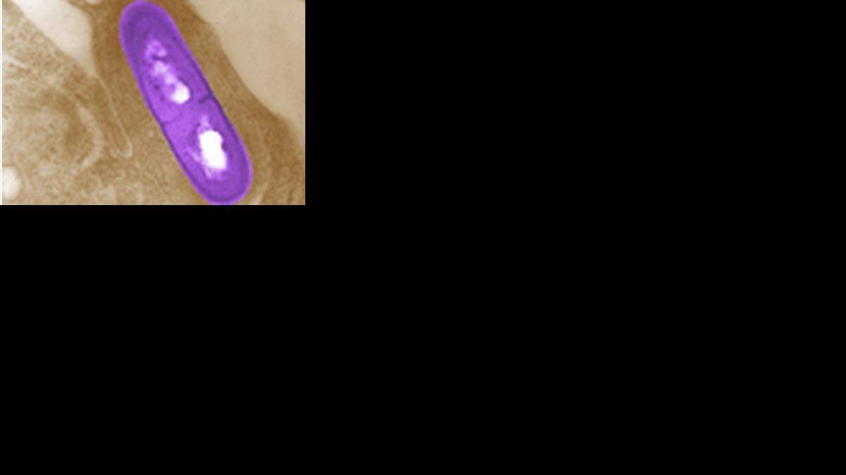 
Listeria monocytogenes
