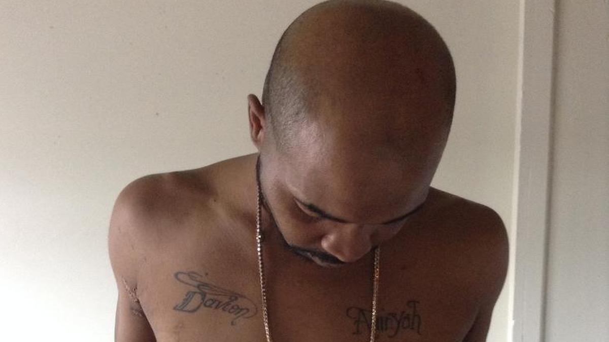 
Former Wichita South and Butler Community College basketball player Robert Lolar shows some of his wounds from being shot eight times by an acquaintance following a family cookout last month in Arkansas City. 
